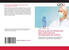 Buchcover von Eficacia de la infiltración peri-articular en artroplastia de rodilla