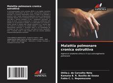 Bookcover of Malattia polmonare cronica ostruttiva