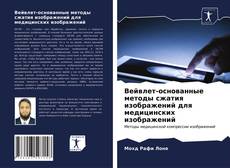 Portada del libro de Вейвлет-основанные методы сжатия изображений для медицинских изображений