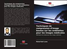 Bookcover of Techniques de compression d'image basées sur les ondelettes pour les images médicales