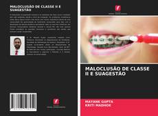 Couverture de MALOCLUSÃO DE CLASSE II E SUAGESTÃO