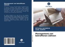 Couverture de Management von betroffenen Zähnen