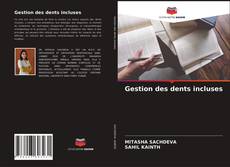 Couverture de Gestion des dents incluses