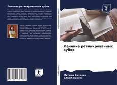 Buchcover von Лечение ретинированных зубов
