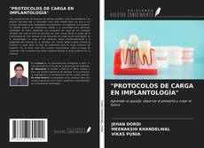 Copertina di "PROTOCOLOS DE CARGA EN IMPLANTOLOGÍA"