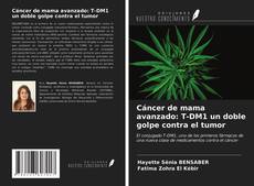 Bookcover of Cáncer de mama avanzado: T-DM1 un doble golpe contra el tumor