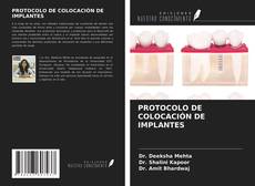 Capa do livro de PROTOCOLO DE COLOCACIÓN DE IMPLANTES 