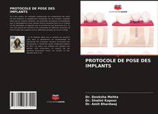 Bookcover of PROTOCOLE DE POSE DES IMPLANTS