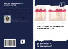Buchcover von ПРОТОКОЛ УСТАНОВКИ ИМПЛАНТАТОВ