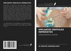 Capa do livro de IMPLANTES DENTALES INMEDIATOS 