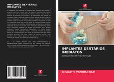 IMPLANTES DENTÁRIOS IMEDIATOS的封面