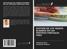 Bookcover of GESTIÓN DE LOS TEJIDOS BLANDOS EN LAS PRÓTESIS PARCIALES FIJAS