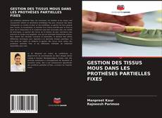 Couverture de GESTION DES TISSUS MOUS DANS LES PROTHÈSES PARTIELLES FIXES