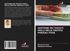 Capa do livro de GESTIONE DEI TESSUTI MOLLI NELLE PROTESI PARZIALI FISSE 