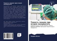 Тяжесть чешуек при остром панкреатите kitap kapağı