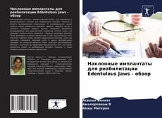 Наклонные имплантаты для реабилитации Edentulous Jaws - обзор kitap kapağı