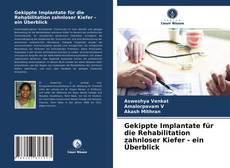 Bookcover of Gekippte Implantate für die Rehabilitation zahnloser Kiefer - ein Überblick