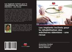 Couverture de Les implants inclinés pour la réhabilitation des mâchoires édentées - une revue