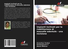 Bookcover of Impianti inclinati per la riabilitazione di mascelle edentule - una revisione