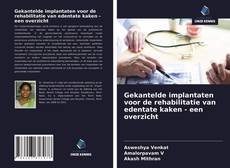 Bookcover of Gekantelde implantaten voor de rehabilitatie van edentate kaken - een overzicht