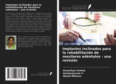 Bookcover of Implantes inclinados para la rehabilitación de maxilares edéntulos - una revisión