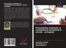 Couverture de Przechylone implanty w rehabilitacji bezzębnych szczęk - przegląd
