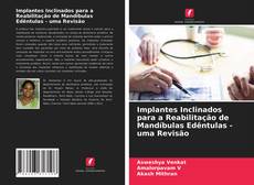 Copertina di Implantes Inclinados para a Reabilitação de Mandíbulas Edêntulas - uma Revisão