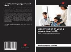 Apexification in young permanent teeth的封面