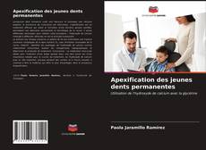 Bookcover of Apexification des jeunes dents permanentes