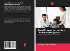 Buchcover von Apexificação em dentes permanentes jovens