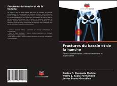 Borítókép a  Fractures du bassin et de la hanche - hoz