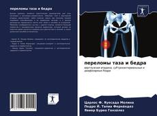 Buchcover von переломы таза и бедра