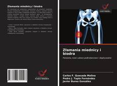 Złamania miednicy i biodra kitap kapağı