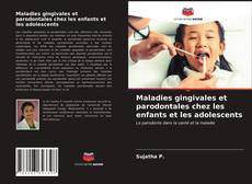 Copertina di Maladies gingivales et parodontales chez les enfants et les adolescents