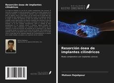 Resorción ósea de implantes cilíndricos kitap kapağı