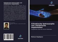 Bookcover of Cilindrische botresorptie van cilindrische implantaten