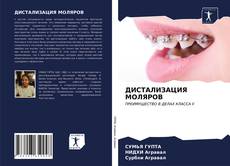 Bookcover of ДИСТАЛИЗАЦИЯ МОЛЯРОВ