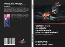 Couverture de Gestione della mandibola completamente edentula con impianti