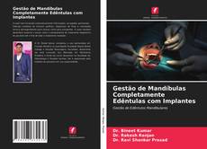 Bookcover of Gestão de Mandíbulas Completamente Edêntulas com Implantes