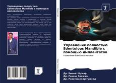 Управление полностью Edentulous Mandible с помощью имплантатов kitap kapağı