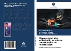 Capa do livro de Management des vollständig zahnlosen Unterkiefers mit Implantaten 