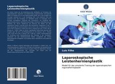 Copertina di Laparoskopische Leistenhernienplastik