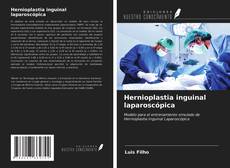 Couverture de Hernioplastia inguinal laparoscópica