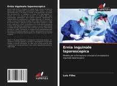 Couverture de Ernia inguinale laparoscopica