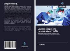 Bookcover of Laparoscopische liesbreukcorrectie