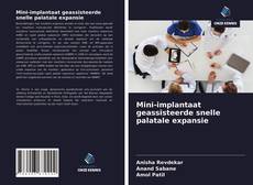 Bookcover of Mini-implantaat geassisteerde snelle palatale expansie