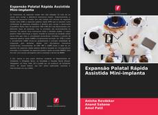 Copertina di Expansão Palatal Rápida Assistida Mini-implanta