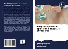 Внерадикулярные временные якорные устройства kitap kapağı