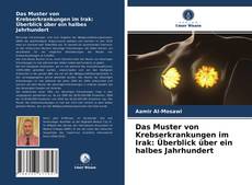 Copertina di Das Muster von Krebserkrankungen im Irak: Überblick über ein halbes Jahrhundert