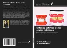 Portada del libro de Enfoque estético de las encías retraídas